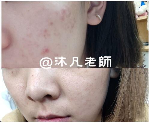 医生治治疮吃瓜,一场别开生面的医患奇遇