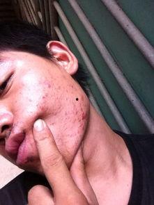 医生治治疮吃瓜,一场别开生面的医患奇遇