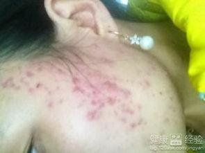 医生治治疮吃瓜,一场别开生面的医患奇遇