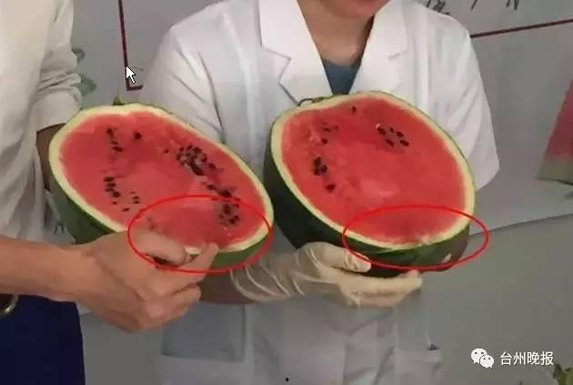 打针后可吃瓜否,能吃瓜吗？揭秘注射后饮食禁忌  第3张